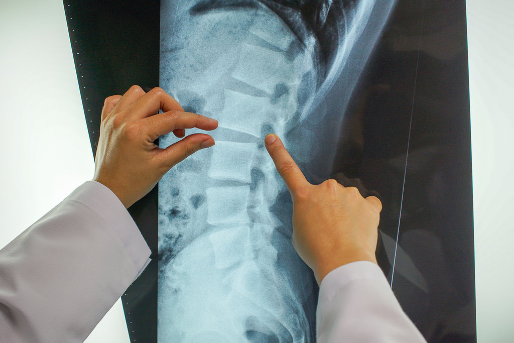closeup of professional doctor is explaining the radiology results to the patient to increase understanding of the cause of the injury. medical and healthcare concept.